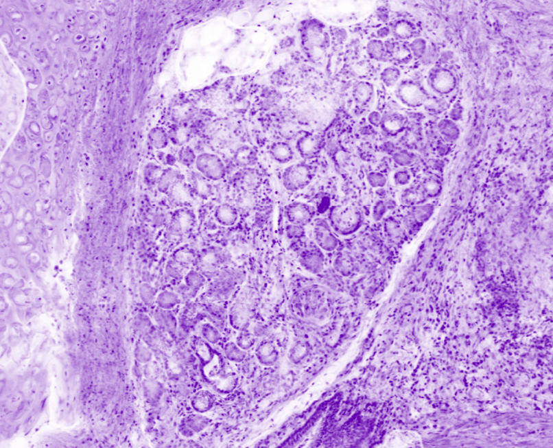 Bronchus seromucous glands