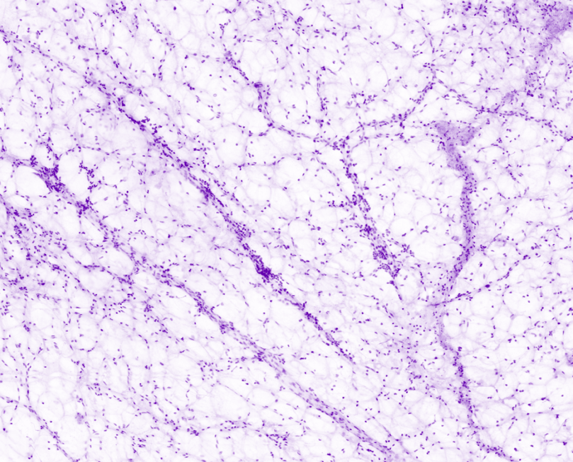 Colon fatty tissue capillaries