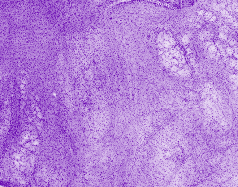 Colon fibrous fatty connective tissue
