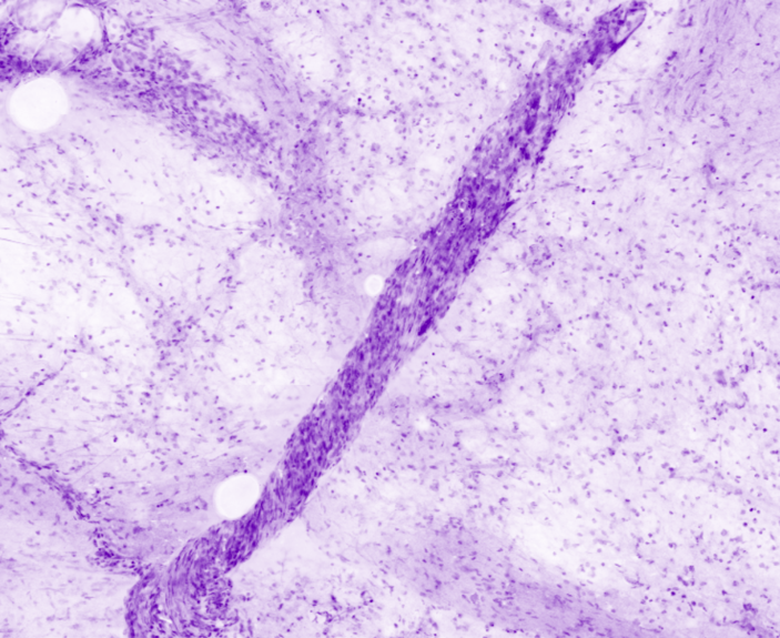 Prostatic nerve within capsula